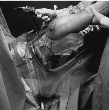 U-Drape, 47