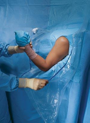 Beach Chair Shoulder Arthroscopy Drape II, Sterile, 10/cs