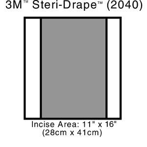 Incise Drape, Overall 14