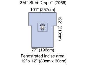 Cesarean-Section Sheet with Aperture Pouch, 77
