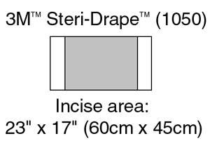 Incise Drape, Overall 32