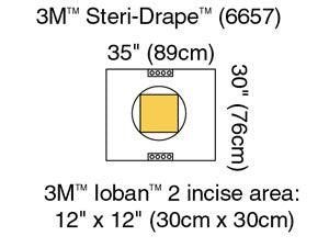 Cesarean-Section Pouch with Iobanâ„¢ 2 Incise Film, 35
