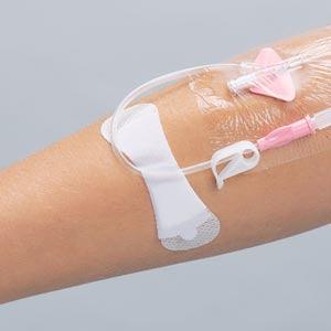 Securement Device, Universal, Small, Sterile, Individually Packaged, 100/bx