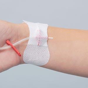 Securement Device, Universal Winged Peripheral IV & Arterial Catheter, Sterile, Individually Packaged with 1 Tape Strip, 100/bx