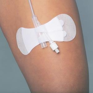Securement Device, Universal, Foley, Large, Sterile, Individually Packaged, 100/bx