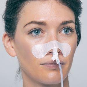 Securement Device, Nasal Gastric Tube, Large, Sterile, Individually Packaged, 100/bx