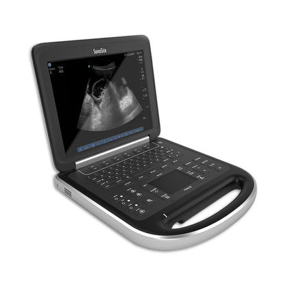 Sonosite Edge Ultrasound System (Please call for Pricing/Availability)