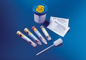 Urinalysis Cup Kit: UA Preservative Plus Plastic Conical Bottom Tube, 8mL Draw 16 x 100mm UA Plus Plastic Conical Bottom Tube, 50/cs